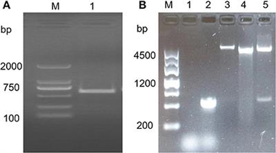 Changes in TFG gene expression in bovine leucocytes transformed by Theileria annulata